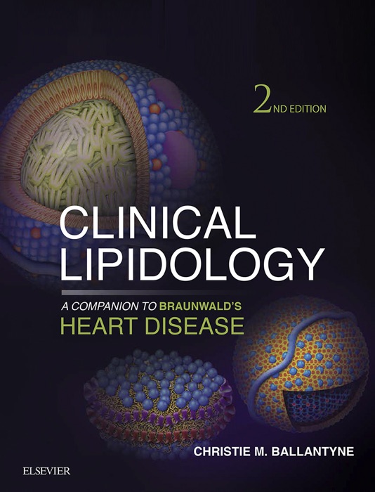 Clinical Lipidology