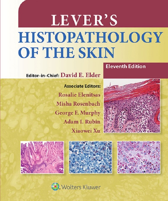 Lever's Histopathology of the Skin: Eleventh Edition