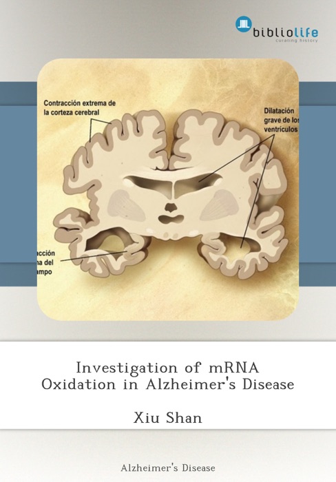 Investigation of mRNA Oxidation in Alzheimer's Disease