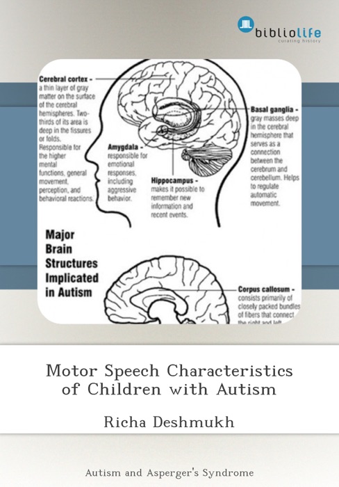 Motor Speech Characteristics of Children with Autism