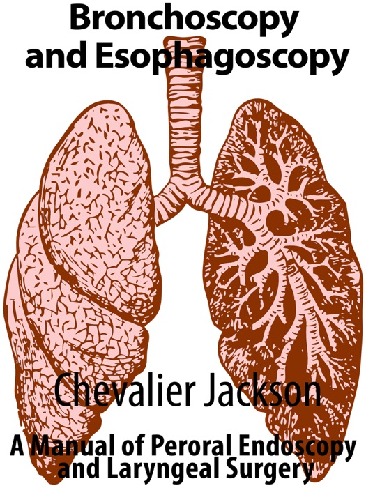 Bronchoscopy and Esophagoscopy