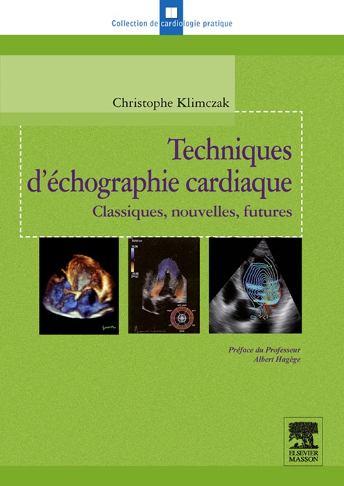 Techniques d'échographie cardiaque