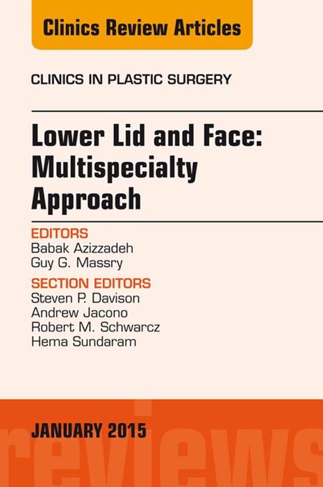 Lower Lid and Midface: Multispecialty Approach