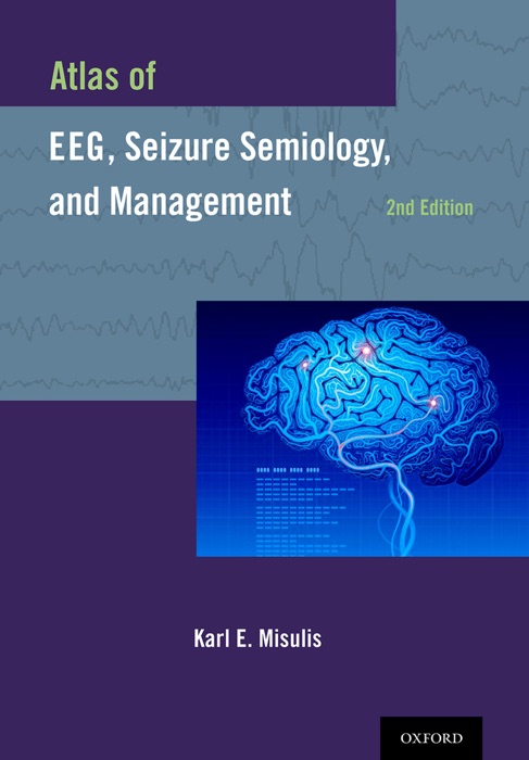 Atlas of EEG, Seizure Semiology, and Management