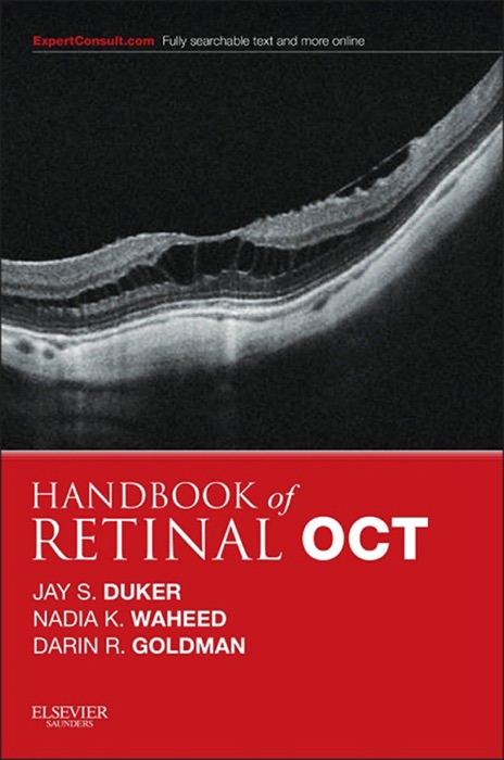 Handbook of Retinal OCT: Optical Coherence Tomography E-Book