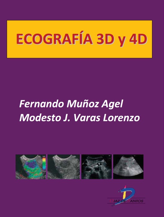 Ecografía 3D y 4D