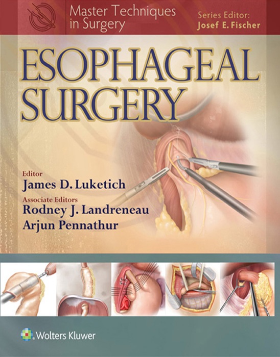 Master Techniques in Surgery: Esophageal Surgery