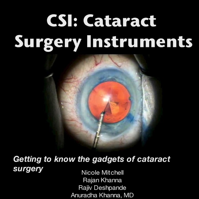 Step by Step Cataract Surgery