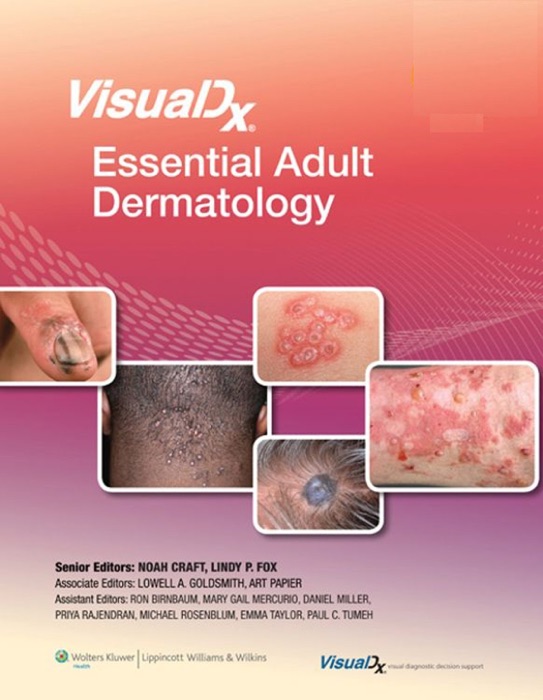 VisualDx: Essential Adult Dermatology