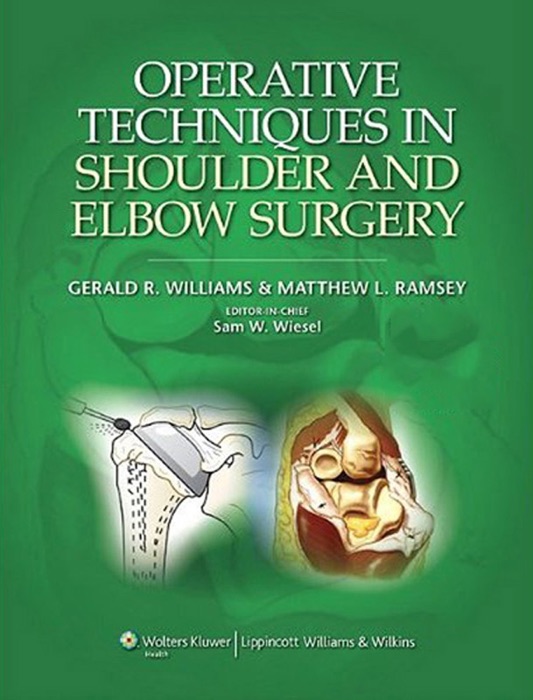 Operative Techniques in Shoulder and Elbow Surgery