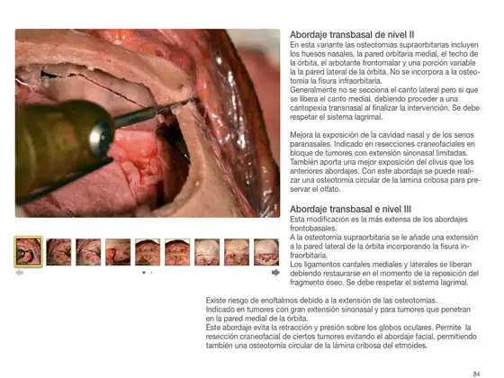 Obrázek 2 Abordajes Quirúrgicos y Osteotomías en Cirugía Cráneo-Maxilo-Facial iphone