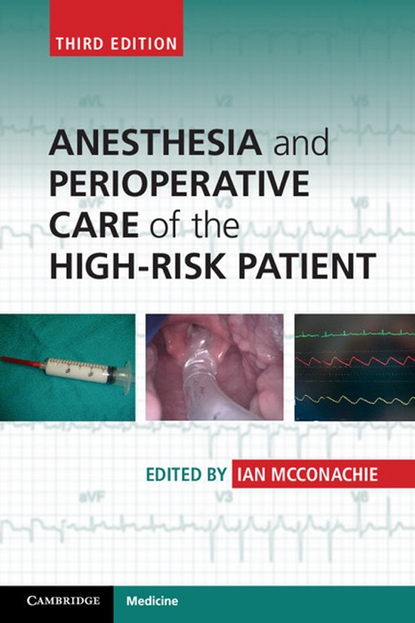 Anesthesia and Perioperative Care of the High-Risk Patient: Third Edition