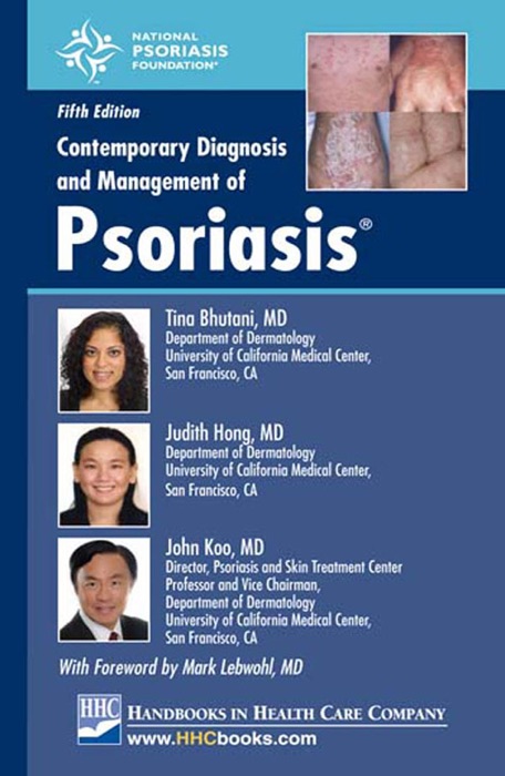 Contemporary Diagnosis and Management of Psoriasis®, 5th edition