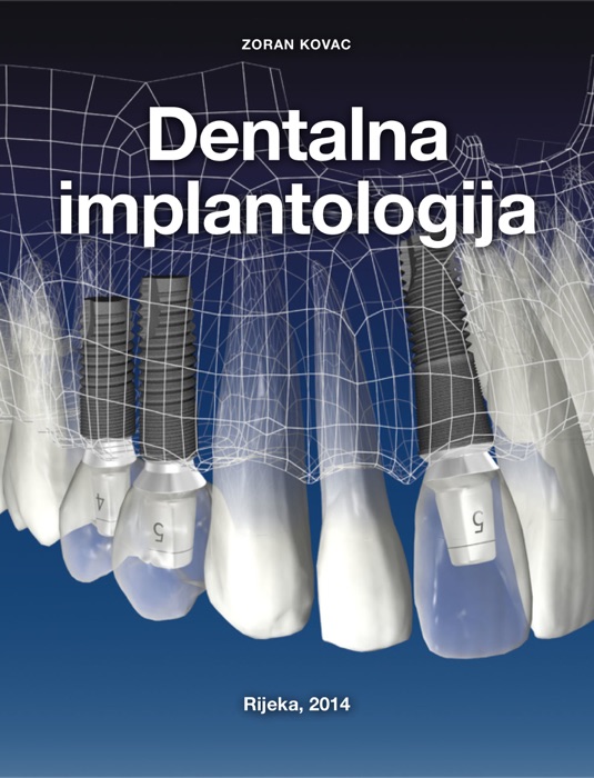 Dentalna implantologija