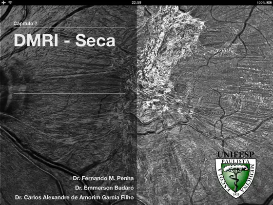 Obraz 4 Condutas em retina - EPM / UNIFESP iphone