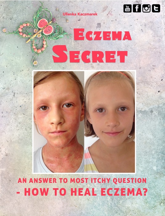 ECZEMA SECRET