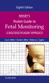 Mosby's Pocket Guide to Fetal Monitoring Mosby's Pocket Guide to Fetal Monitoring