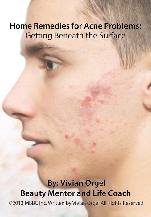 Home Remedies for Acne Problems: Getting Beneath the Surface