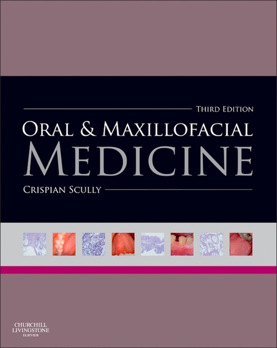Oral and Maxillofacial Medicine - E-Book