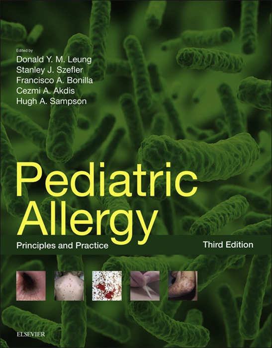 Pediatric Allergy: Principles and Practice