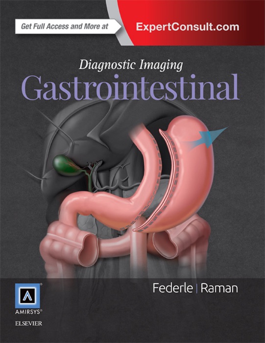 Diagnostic Imaging: Gastrointestinal E-Book