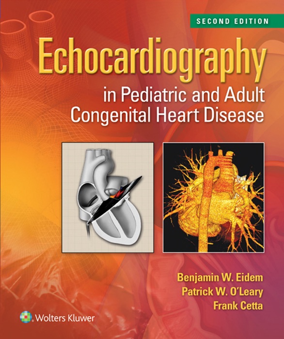 Echocardiography in Pediatric and Adult Congenital Heart Disease: Second Edition