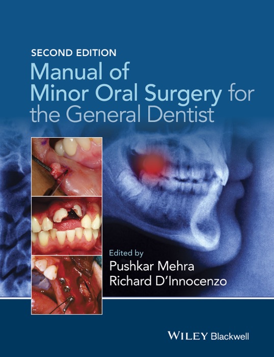 Manual of Minor Oral Surgery for the General Dentist