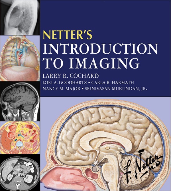 Netter's Introduction to Imaging