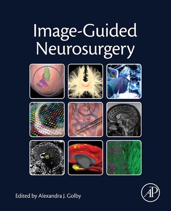 Image-Guided Neurosurgery