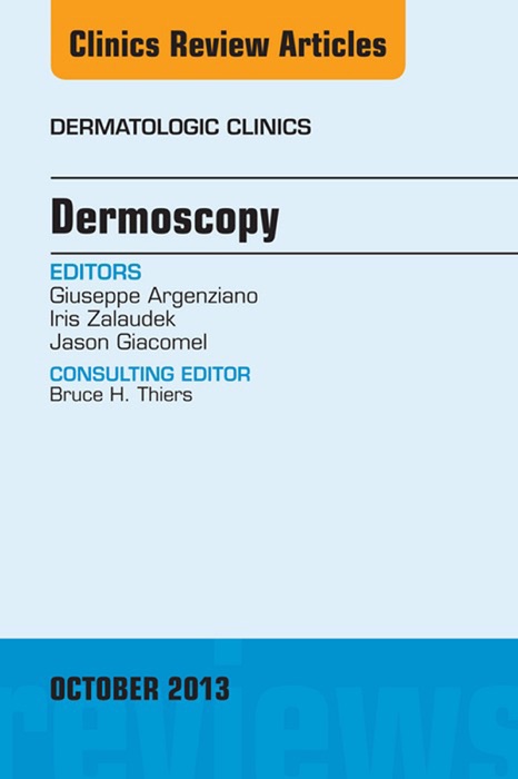 Dermoscopy