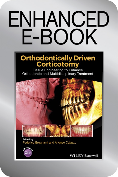 Orthodontically Driven Corticotomy