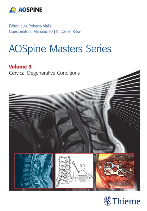 AOSpine Masters Series Volume 3: Cervical Degenerative Conditions