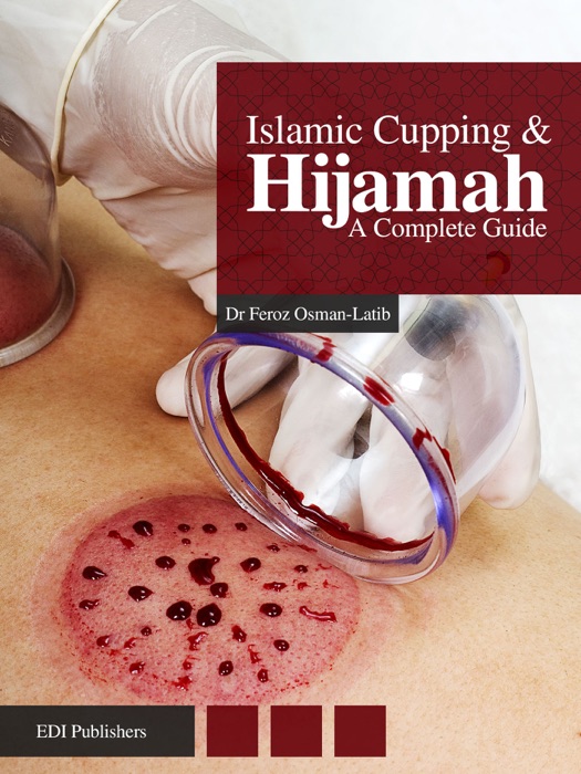 Islamic Cupping & Hijamah