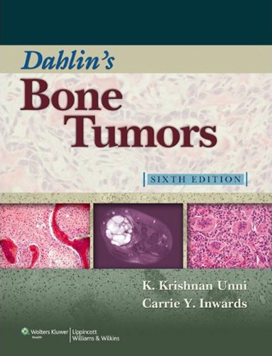 Dahlin's Bone Tumors: Sixth Edition