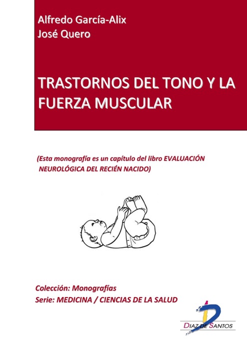 Trastorno del tono y fuerza muscular