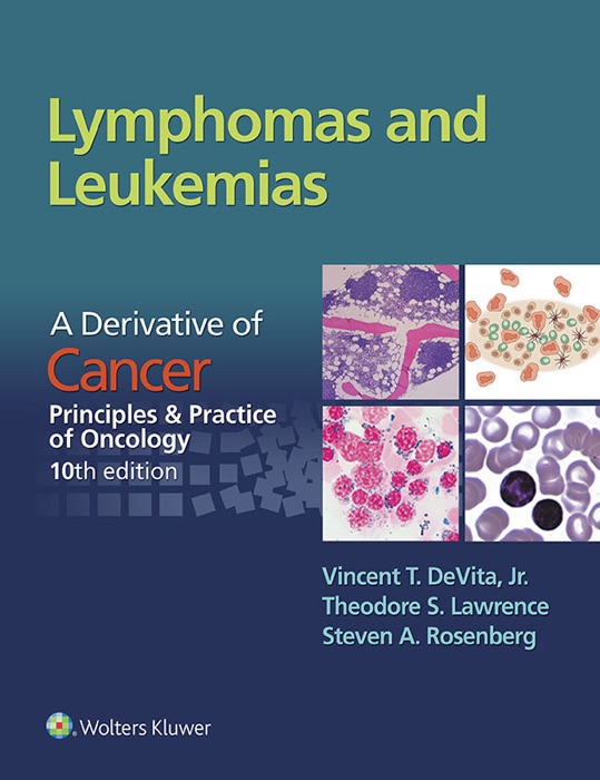 Lymphomas and Leukemias