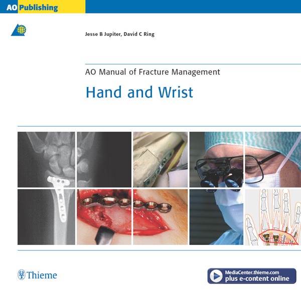 AO Manual of Fracture Management: Hand & Wrist