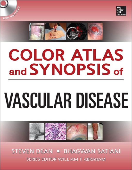 Color Atlas and Synopsis of Vascular Disease