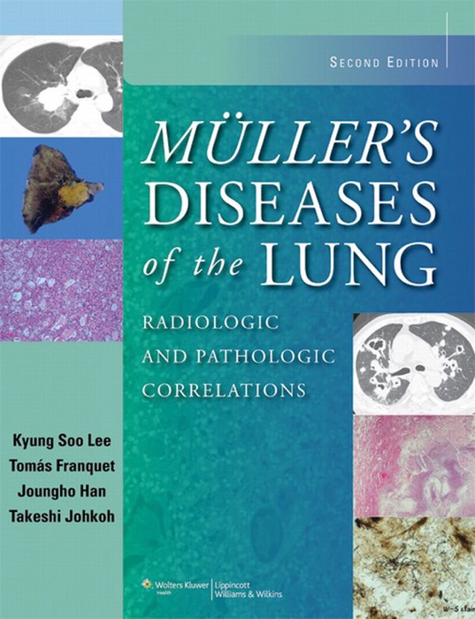 Muller's Diseases of the Lung: Second Edition