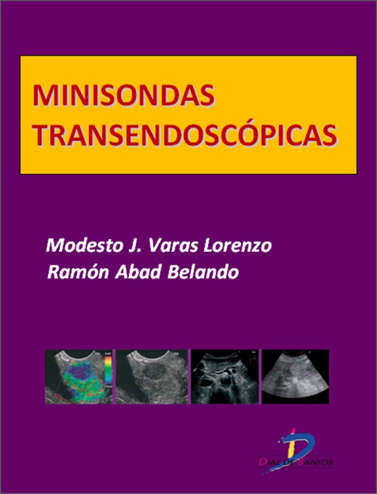 Minisondas transendoscópicas