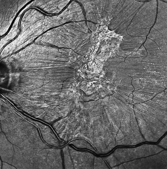 Condutas em retina - EPM / UNIFESP