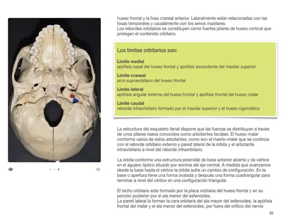 Screenshot 3 Abordajes Quirúrgicos y Osteotomías en Cirugía Cráneo-Maxilo-Facial iphone