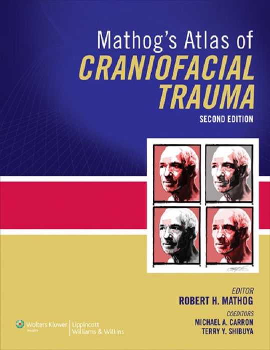 Mathog's Atlas of Craniofacial Trauma: Second Edition