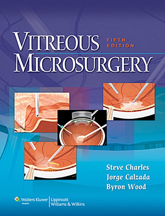 Vitreous Microsurgery: Fifth Edition