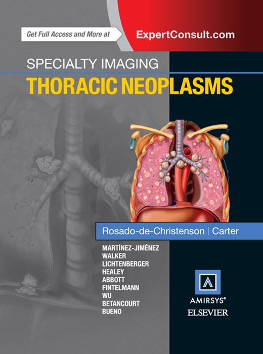 Specialty Imaging: Thoracic Neoplasms E-Book