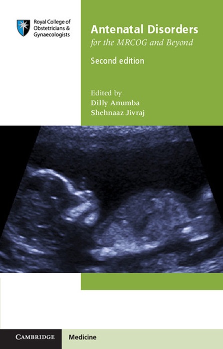 Antenatal Disorders for the MRCOG and Beyond: Second Edition