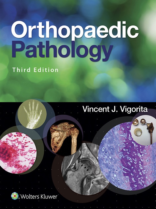 Orthopaedic Pathology: Third Edition