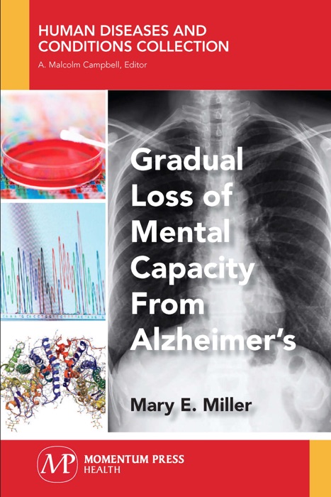 Gradual Loss of Mental Capacity from Alzheimer’s