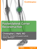 Posterolateral Corner Reconstruction - Christopher J. Wahl, MD