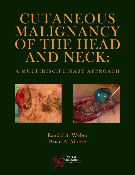 Cutaneous Malignancy of the Head and Neck